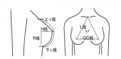 假體隆胸10個(gè)人有9個(gè)做完后悔？后遺癥這么恐怖